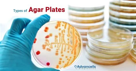 dissolve lb agar without autoclave|how to dry agar plates.